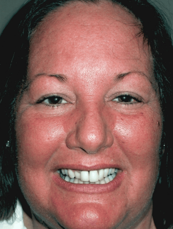 Before cosmetic treatment