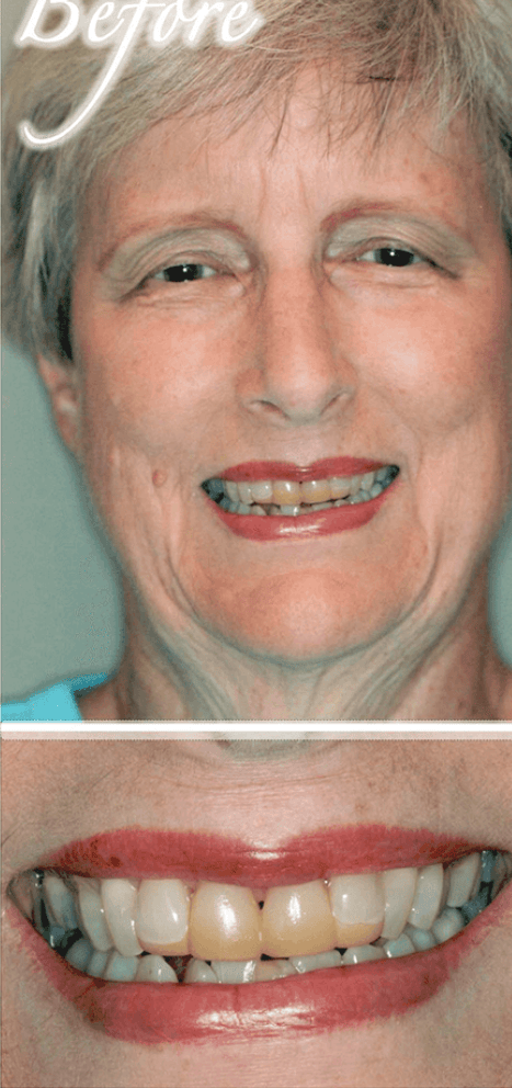 Smile makeover before photo 7