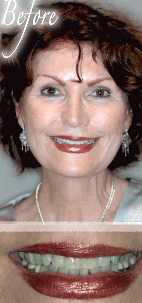 Smile makeover before photo 8
