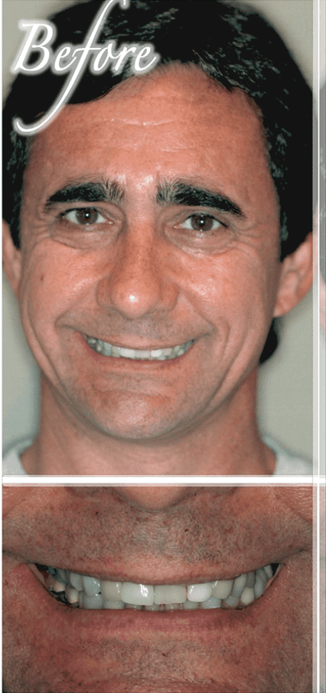 Smile makeover before photo 9