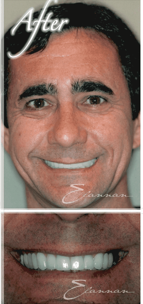 Smile makeover after photo 9