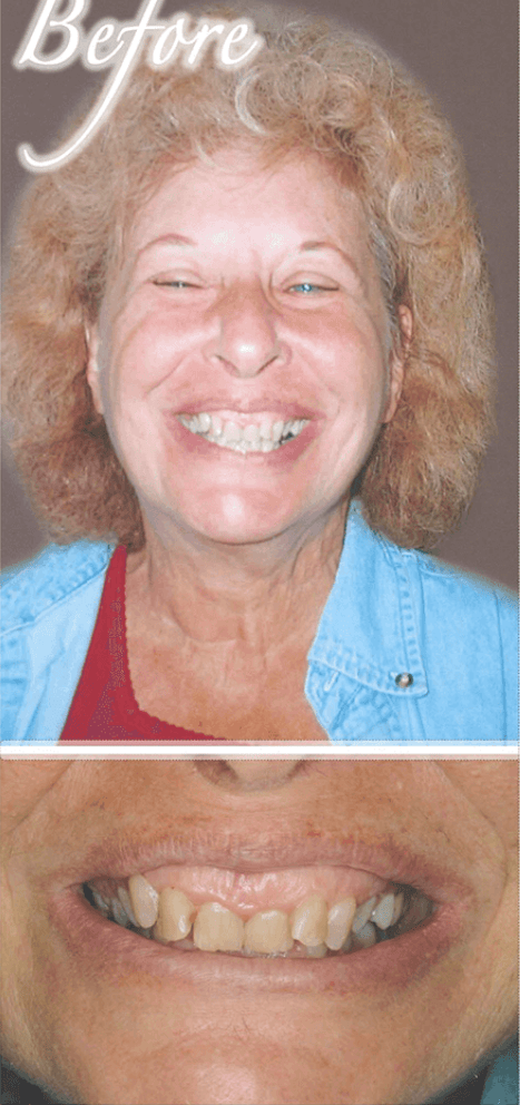 Smile makeover before photo 10