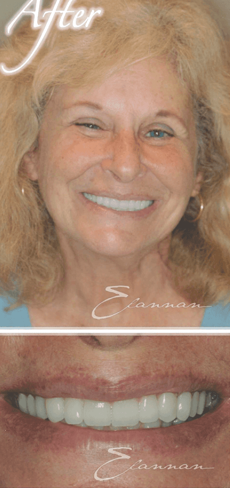 Smile makeover after photo 10