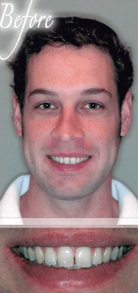 Smile makeover before photo 2