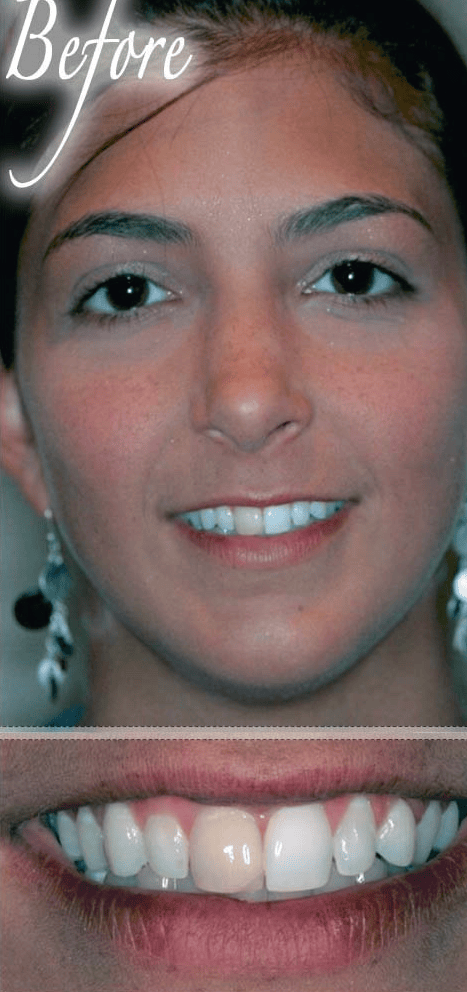 Smile makeover before photo 3