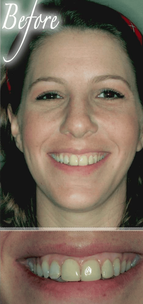 Smile makeover before photo 1